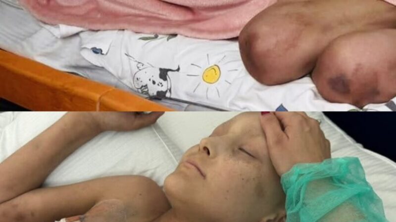 The Unbreakable Spirit of Branson Blevins: A Story of Courage, Community, and Hope in the Face of Childhood Cancer